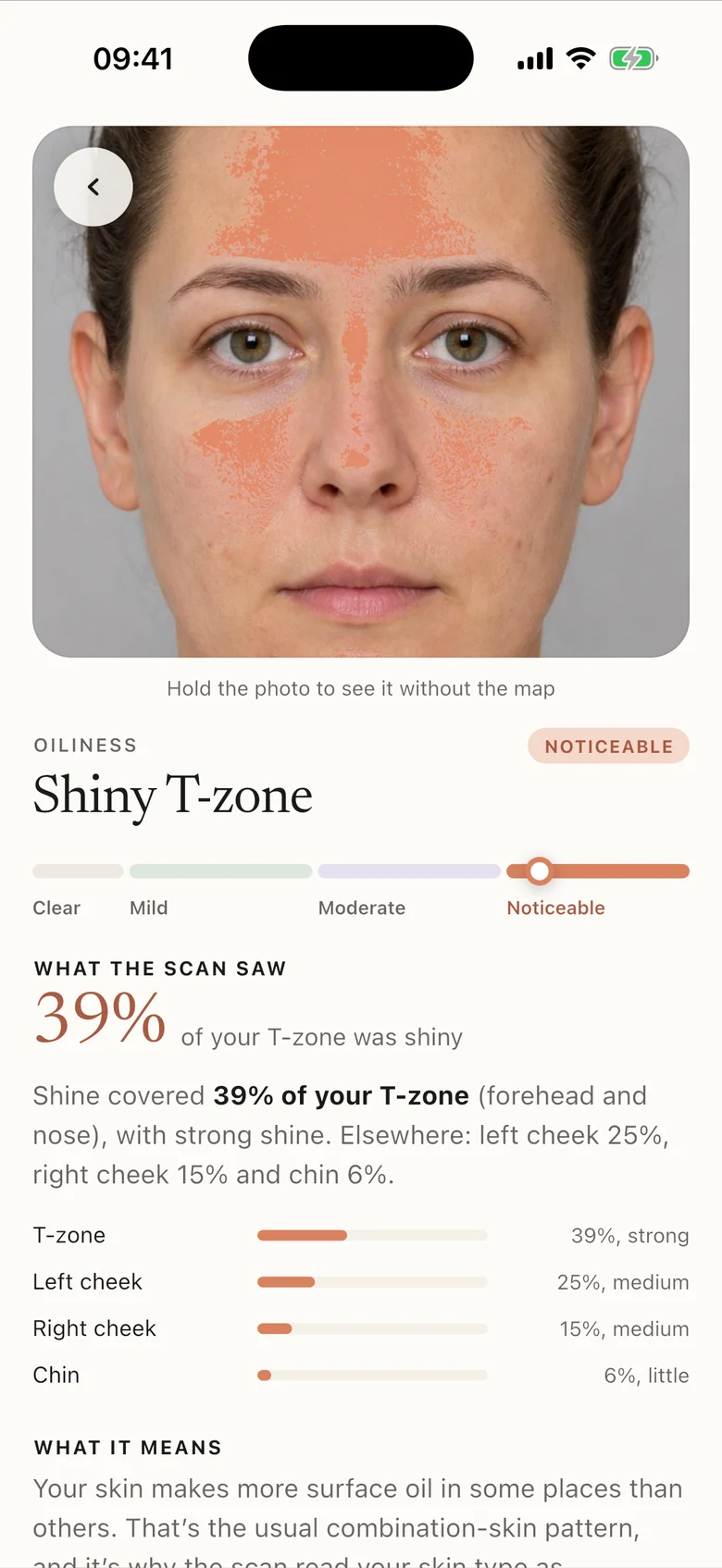 One finding opened: a shiny T-zone shown as a map, with its share of each area