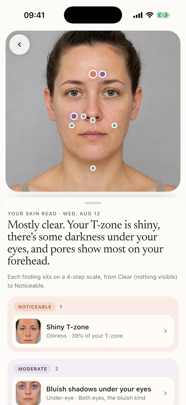 Glowbie's skin read: a portrait with marked areas and a summary of what the photo shows